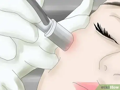 Step 2 爱你的脸。