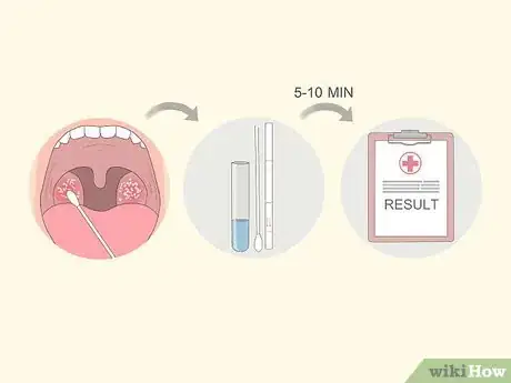 Step 4 要求医生进行链球菌咽喉炎快速检测。