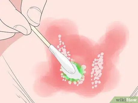 Step 4 涂抹抗病毒乳膏（如有）。