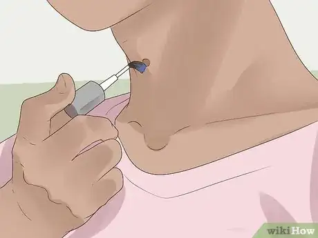 Step 1 用指甲油盖着皮赘。