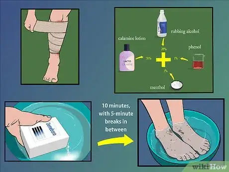 Step 4 准备一些在家用的治疗方法。