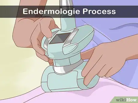 Step 2 尝试深受名人喜爱的Endermologie脂肪雕塑仪。