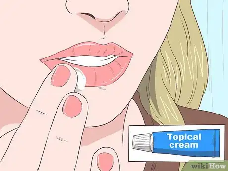 Step 11 使用局部抗病毒药物。