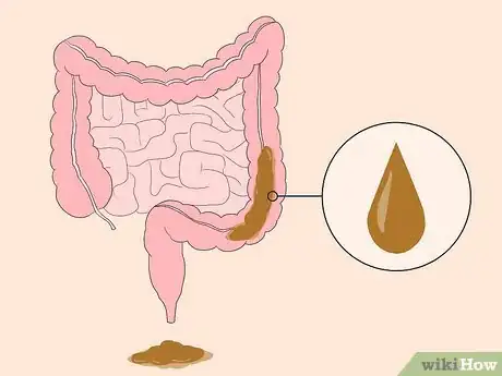 Step 4 留心腹泻的发生。