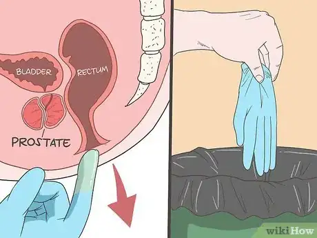 Step 10 缓慢地抽出手指，然后丢掉手套。