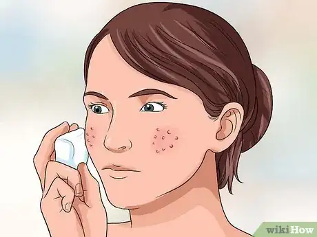 Step 2 用冰块敷脸。
