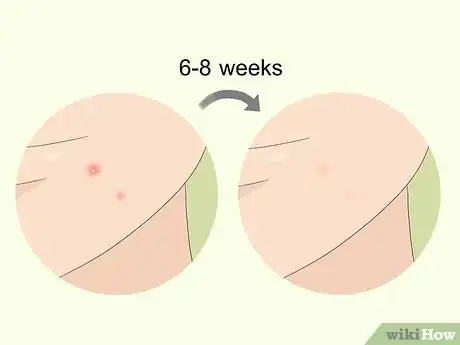 Step 4 给药物时间发挥作用。