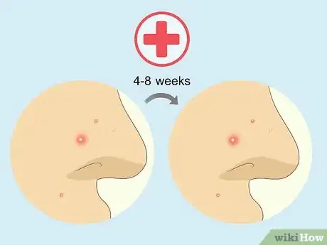 Step 2 检查皮肤。