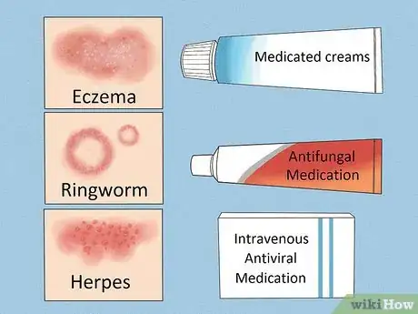 Step 3 向医生咨询处方药。