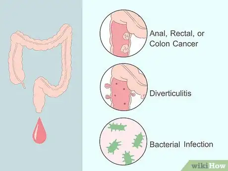 Step 2 了解其它可能的状况。