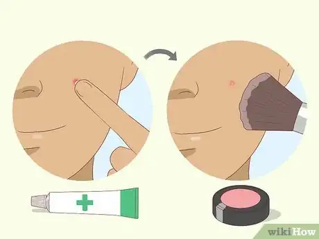 Step 3 擦了外用药膏再化妆。