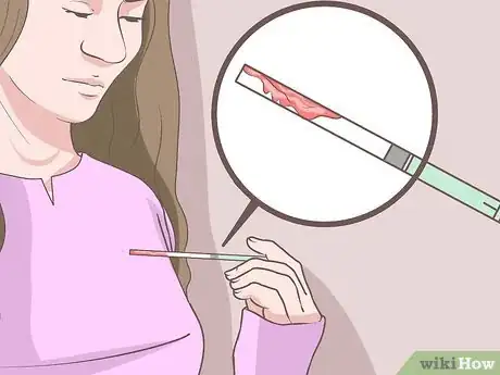 Step 2 确定不孕的原因。