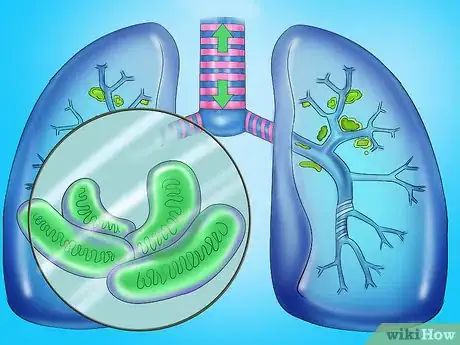 Step 6 提防潜伏性结核感染。