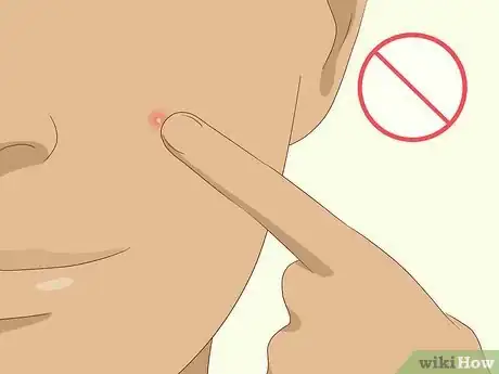 Step 4 别让脸接触油腻的东西。
