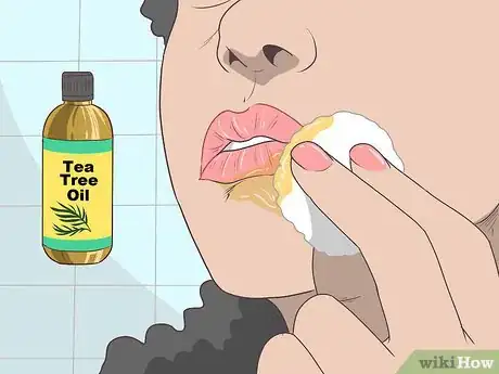 Step 2 使用茶树油。