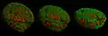 Cell nucleus in prophase from various angles