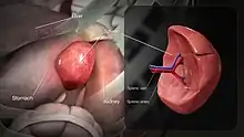 3D medical animation still showing structure of as well as location of the spleen in human body