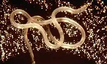 Adult "Loa loa" filarial worm