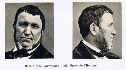 A Frenchman from the Auvergne - of the Alpine (Alpinoid) type