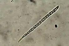 Acicular spore of B. schweinitzii, 65 x 6 micrometres, photographed through a compound microscope, x1000