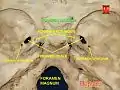 Foramen lacerum