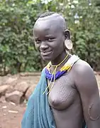 Beauty scarification, Suri tribe