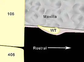 Diagram showing a longitudinal section through a typical blind wolf tooth.