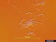 Conidia of cherry leaf spot