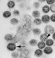 Cygnet River virus