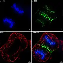 Epifluorescent imaging of the three components in a dividing human cancer cell. DNA is stained blue, a protein called INCENP is green, and the microtubules are red. Each fluorophore is imaged separately using a different combination of excitation and emission filters, and the images are captured sequentially using a digital CCD camera, then overlaid to give a complete image.