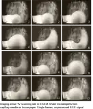 Imaging at true TV scanning rate in ESEM: Water microdroplets from capillary needle on tissue paper. Photos from TV monitor displaying single frames of video recording. Unprocessed BSE signal, field width 380 µm.