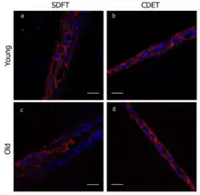 Organization of elastin in equine tendons. With increasing age, there is a decrease in elastin content.