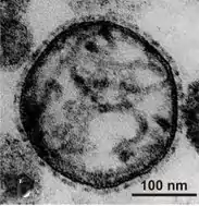 electron microscopy of murine respirovirus virus