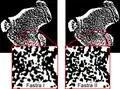 Image showing the differences between the Fastra I and the Fastra II in spatial resolution that is required to analyze changes of bone parameters