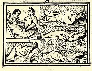 Image 20Depiction of smallpox in Franciscan Bernardino de Sahagún's history of the conquest of Mexico, Book XII of the Florentine Codex, from the defeated Aztecs' point of view (from History of medicine)