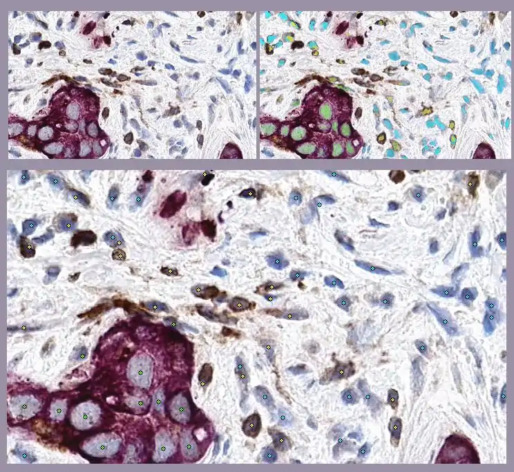 GemIdent identifying cancer cells, T-cells, and background nuclei in a microscopic image