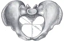 Diameters of superior aperture of lesser pelvis—female