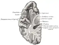 Section of brain showing upper surface of temporal lobe