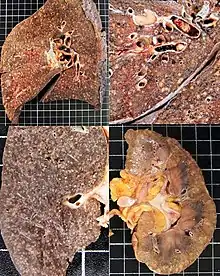 Gross pathology of the lung, spleen and kidney, showing micronodules (1–4 mm in diameter) which resemble millet seeds