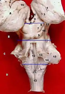 Dissection of human midbrain with middle cerebellar peduncle labeled.