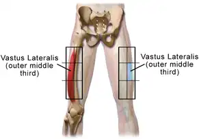 Vastus lateralis site in adult