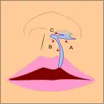 Movement of the flaps; flap A is moved between B and C. C is rotated slightly while B is pushed down. Note how the cupid's bow is created.