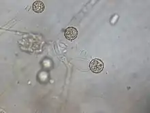 Monoblepharis polymorpha growing on a sesame seed in water collected from a vernal pool near Orono, Maine. Shown are the spiny, brownish resting spores sitting on top the empty oogonia. On the sides of the oogonia are empty antheridia.