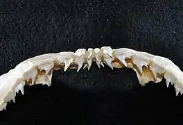 Upper teeth