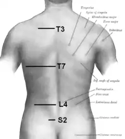 Orientation of vertebral column on surface. T3 is at level of medial part of spine of scapula. T7 is at inferior angle of the scapula. L4 is at highest point of iliac crest. S2 is at the level of posterior superior iliac spine. Furthermore, C7 is easily localized as a prominence at the lower part of the neck.