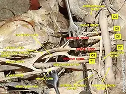 Brachial plexus