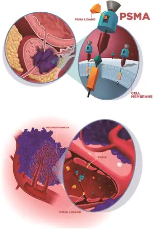 PSMA expression and radiotracer uptake in prostate cancer