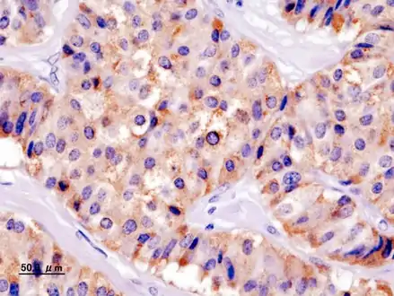 Insulin immunostain