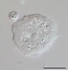 Acanthamoeba sp.