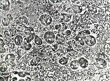 P. polycephalum amoebae growing on lawns of live E. coli. The bacterial cells are approx 1 micron in diameter, amoebae are approx 10 microns in diameter. Bright circular structures inside the amoebae are vacuoles, nuclei are pale grey circles each containing a darker nucleolus. (Phase contrast microscopy.)